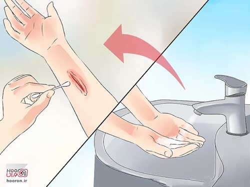 4 روش ضدعفونی و استریل کردن دست ها